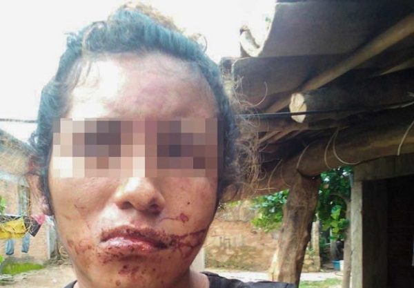 Agreden a mujer trans en Oaxaca; acusa a hijos de exalcalde