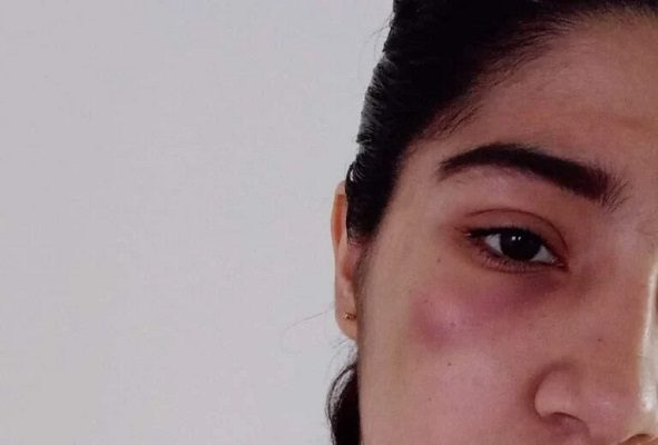 Alumna denuncia golpiza en los baños de la Escuela Normal Ecatepec