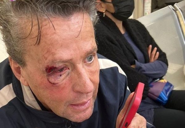 Alfredo Adame fue golpeado afuera de su casa; prevé acciones legales