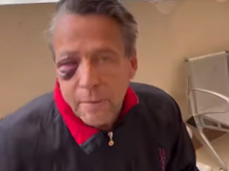 Alfredo Adame confirma que necesitará cirugía tras brutal golpiza