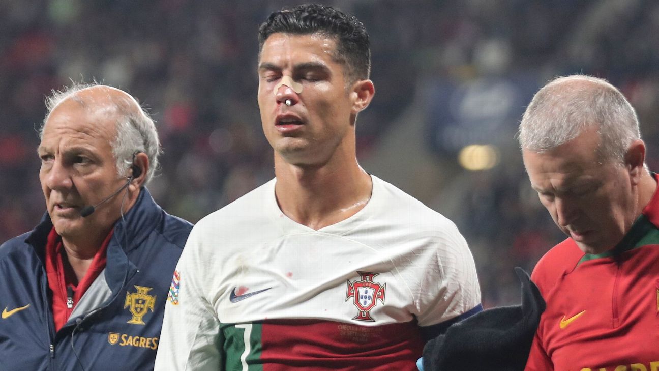 Cristiano Ronaldo recibe fuerte golpe en pleno partido