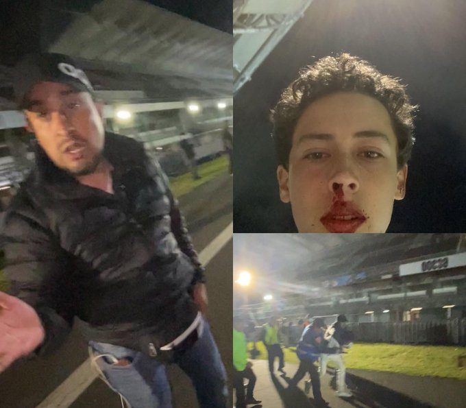 Denuncian golpiza a menor en acceso a concierto de Dua Lipa en CDMX