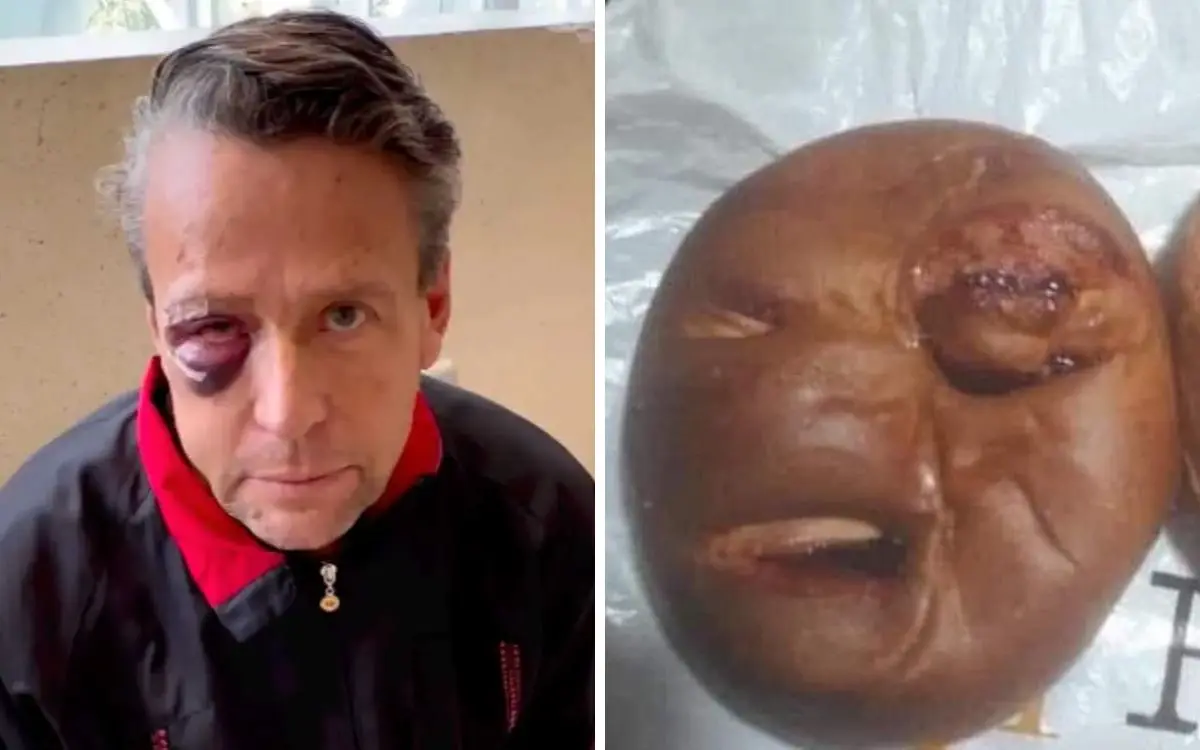 Lanzan pan inspirado en golpiza que recibió Alfredo Adame