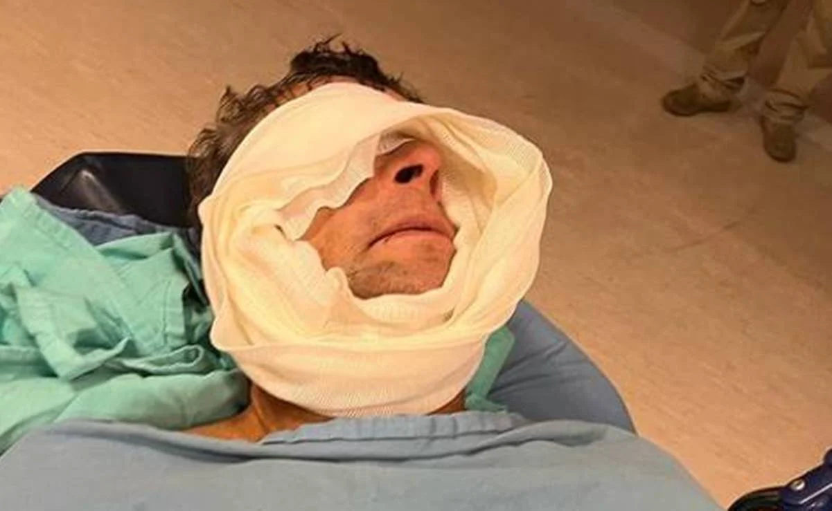 Así quedó Alfredo Adame tras cirugía de emergencia