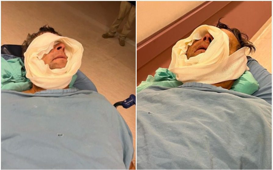 Alfredo Adame bromea sobre su rostro tras cirugía: "A Fabiruchis le pegaron más"