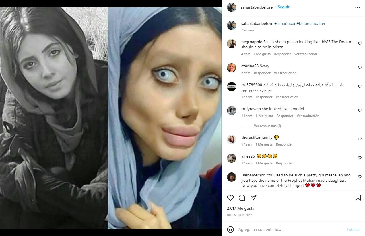 Viralizan #VIDEO del rostro real de la 'Angelina Jolie zombie'