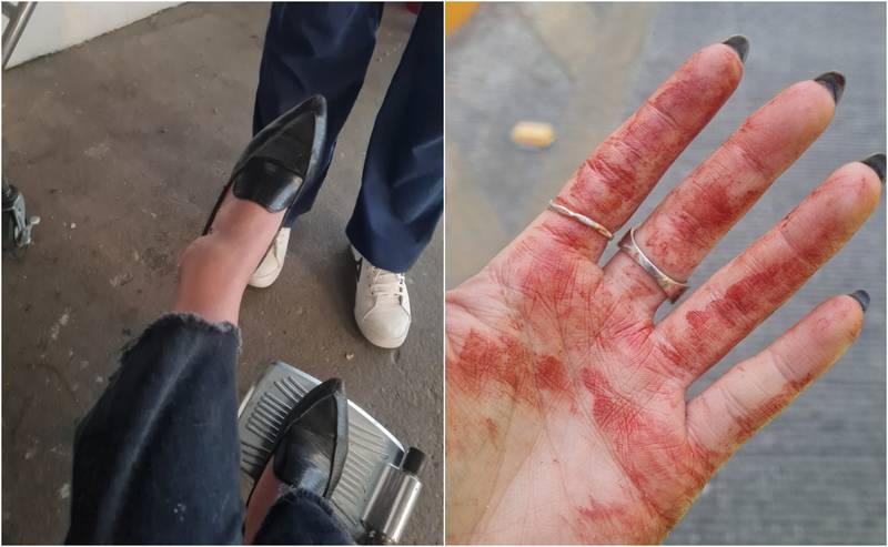 Un caso más: Mujer salta de camión en CDMX para evitar presunto secuestro