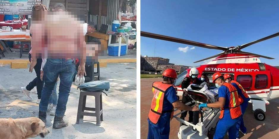 Explosión de tanque de gas en tianguis de Huehuetoca
