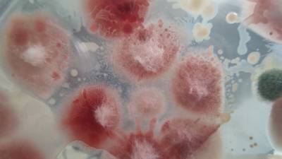 Cofepris descarta hongo en medicamento relacionado con casos de meningitis en Durango