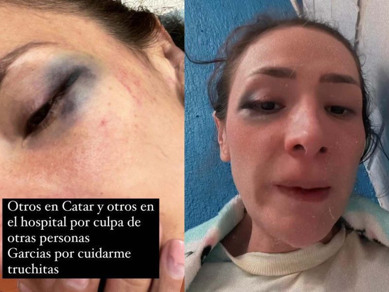La influencer Pao Poulain, cuñada de Yuya, denuncia haber sido golpeada #VIDEO