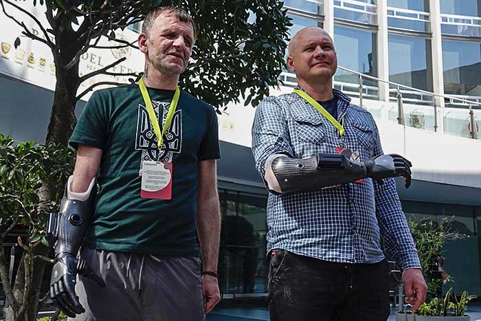 Soldados ucranianos reciben prótesis 'biónicas' en México