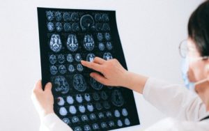 Pandemia de COVID-19 “envejeció” el cerebro de los adolescentes, según estudio
