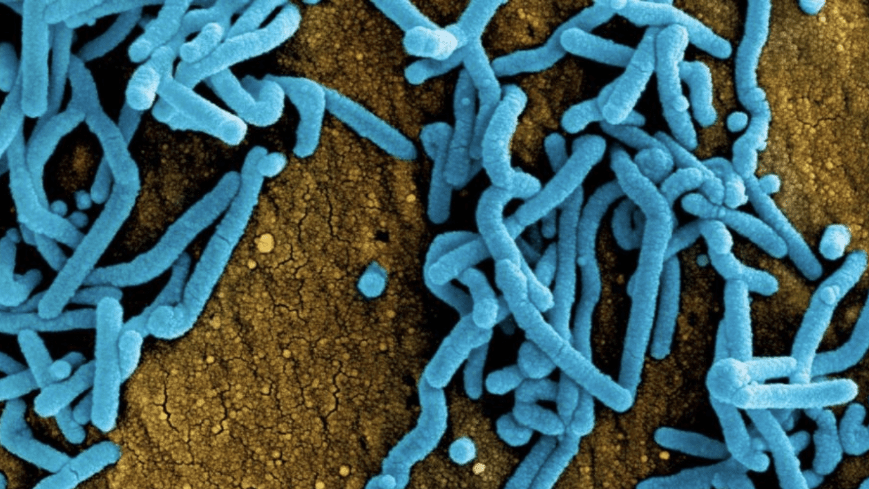 Guinea Ecuatorial declara alerta sanitaria por virus de Marburgo