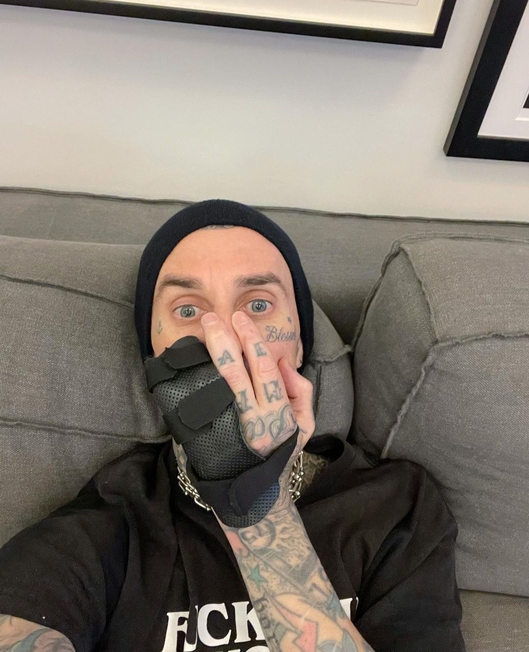 Travis Barker, de Blink-182, se somete a cirugía por lesión