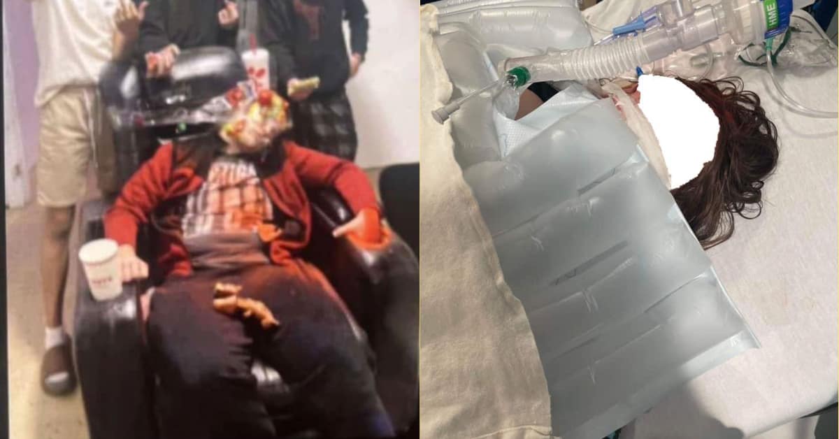 Joven autista termina conectado a un ventilador por bullying