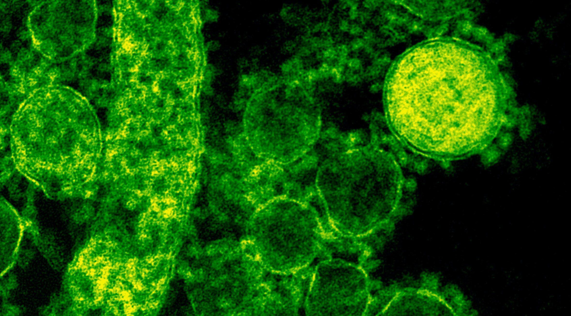 ¿Será una buena idea revivir un virus zombie?, científicos lo hicieron