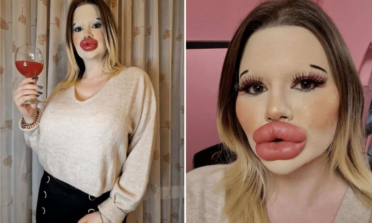 Conoce a la mujer con los labios más grandes del mundo
