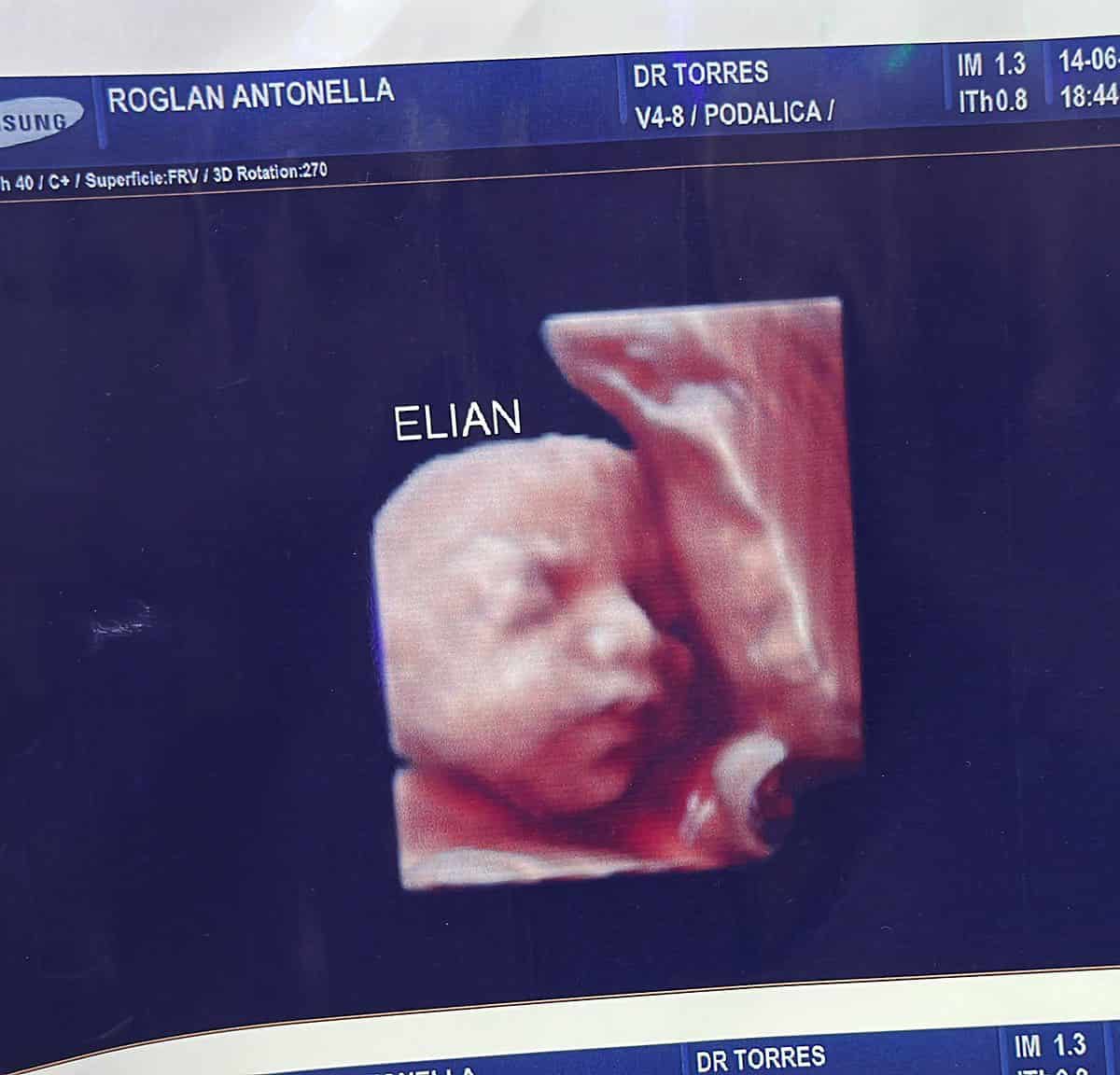 Clínica usa la misma ecografía 5D, para varias embarazadas