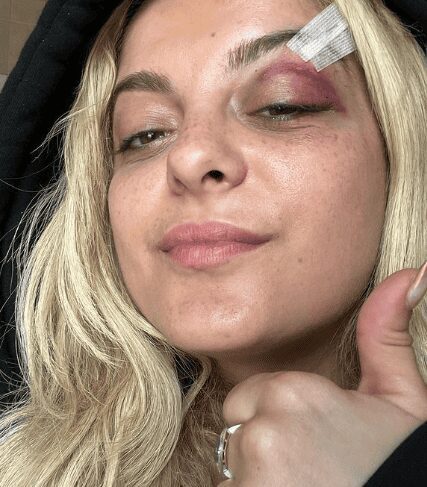 Bebe Rexha resulta herida en un concierto por fan