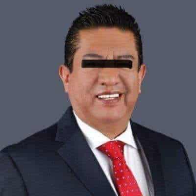 Ex oficial mayor de Hidalgo engañó con la compra de crema quirúrgica