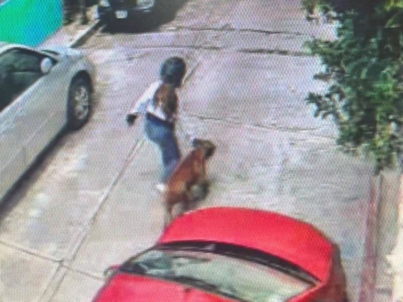 En Morelos un niño fue atacado por un pitbull, le arrancó el cuero cabelludo