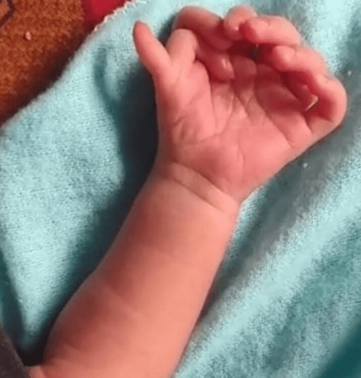 Un bebé nace con un total de 26 dedos en sus manos y pies, y algunos lo ven como la reencarnación de una deidad
