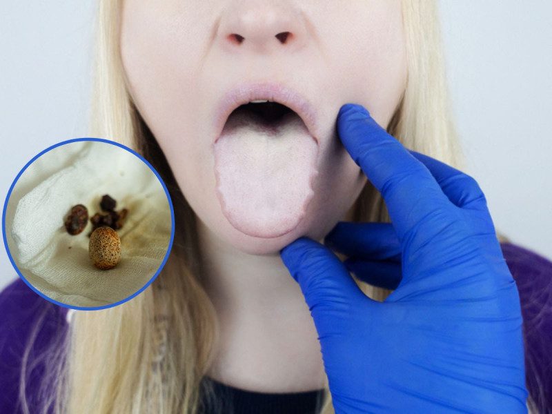 Estos 3 alimentos ‘saludables’ inflaman más la vesícula, hígado y páncreas que comidas fritas