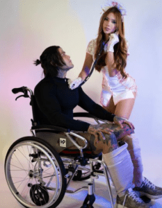 Yeferson Cossio, influencer, se somete a cirugía para alargar sus piernas