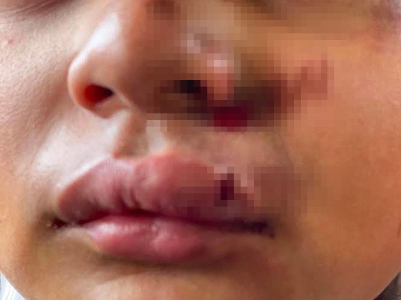 Mujer denuncia golpes a su hija en primaria Rébsamen de Oaxaca