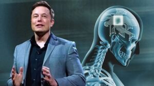 Elon Musk, anuncia el primer implante humano de Neuralink