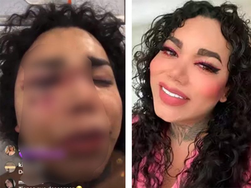 Paola Suárez, sale del hospital; su novio la demanda