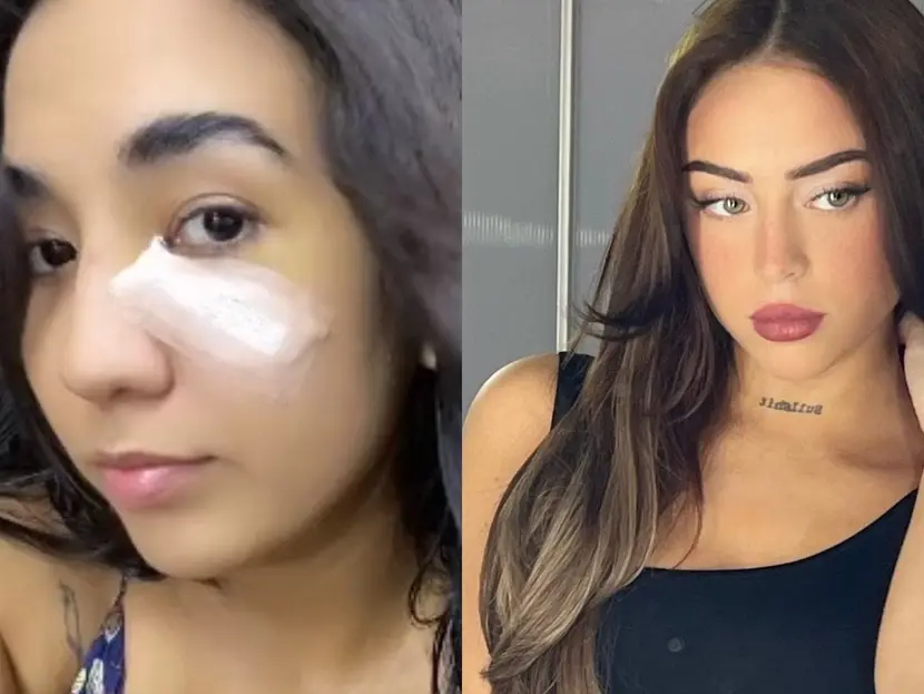 Fan de Nicki Nicole terminó en hospital por recibir botellazo de la cantante