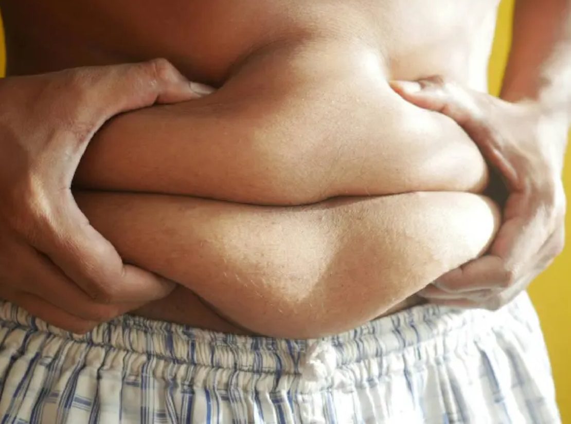 Más de mil millones de personas tienen obesidad a nivel mundial, según estudio