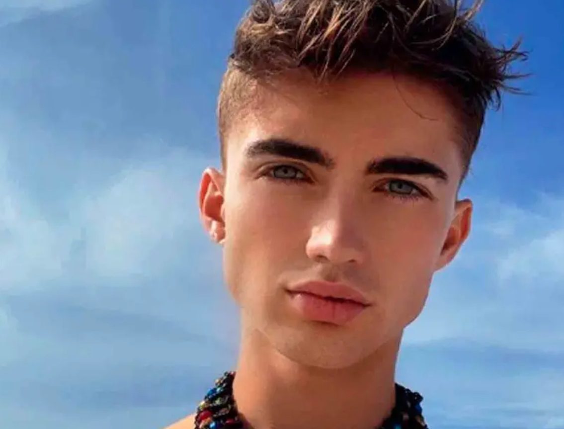 ‘Muñeco humano’ casi fallece tras operación ilegal de glúteos