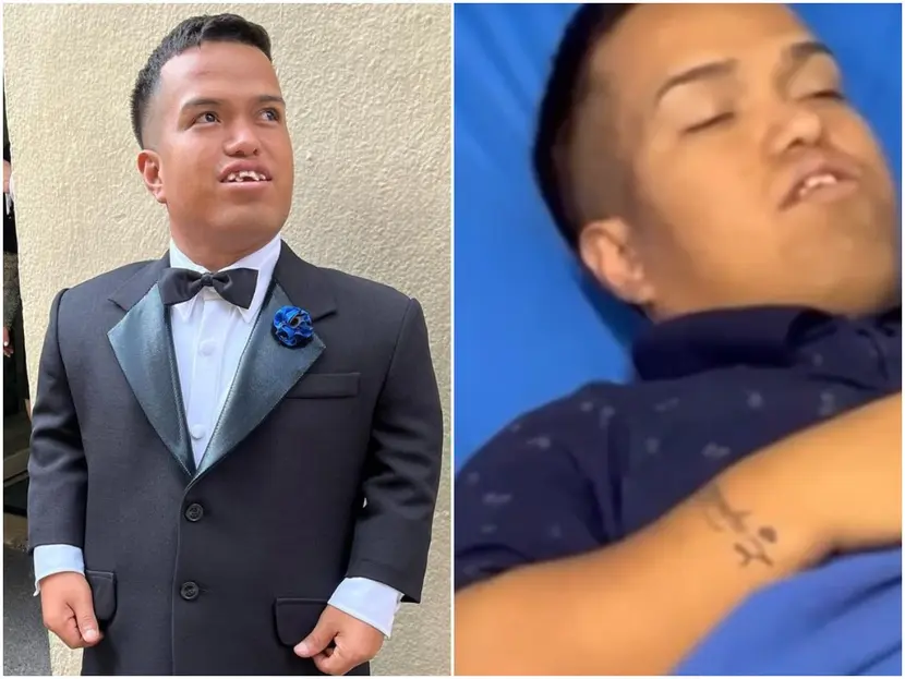 Medio Metro, hospitalizado por mordedura de perro rabioso