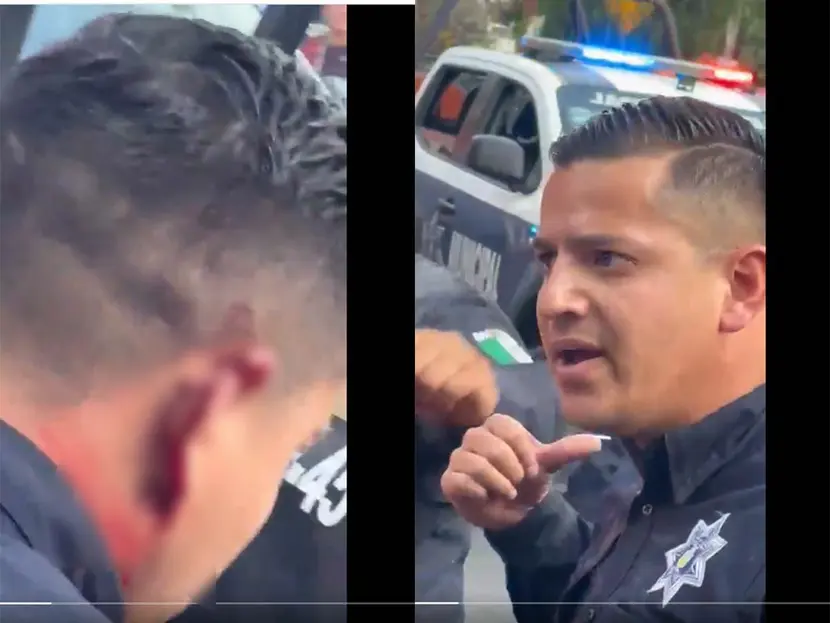 Ratero muerde oreja de policía y le arranca un pedazo