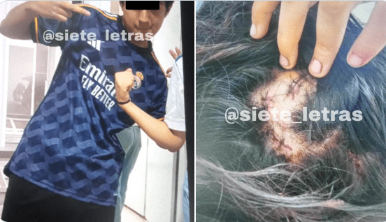 Adolescente de 13 años ataca y apuñala a su exnovia en CDMX, tras negarse en regresar con él