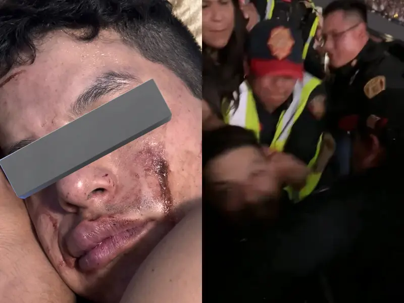 Fan de Madonna denuncia que policías lo golpearon en concierto