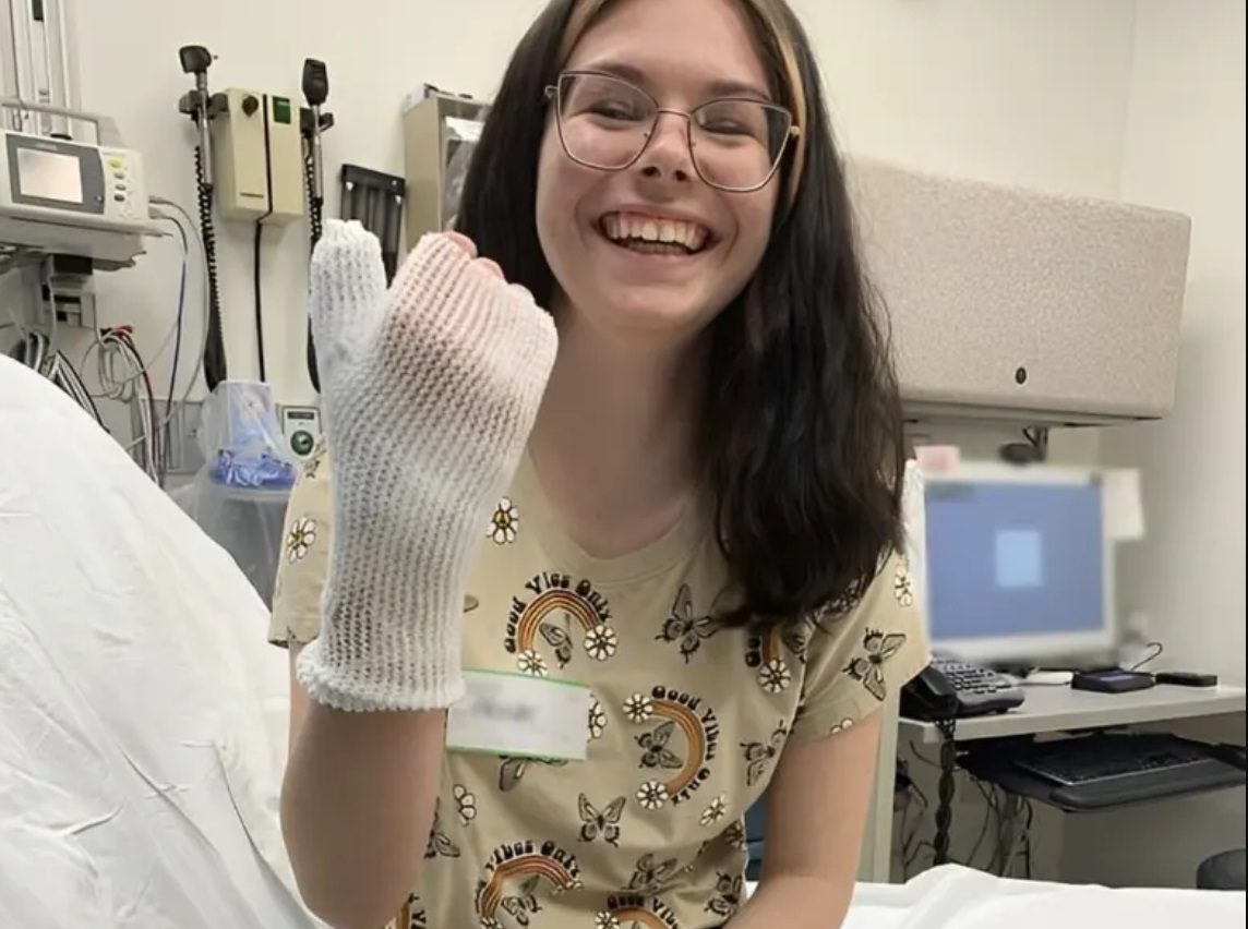 Joven sufre quemaduras graves al usar receta viral de TikTok para depilarse la mano