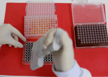 OMS confirma caso humano de influenza aviar AH5N2 en México