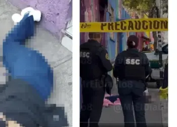 Exhibe ‘lipo’ mal hecha y la matan en CDMX