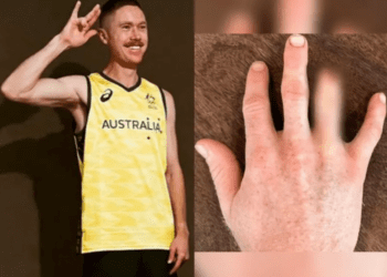 Para estar en París 2024, deportista australiano se amputa dedo