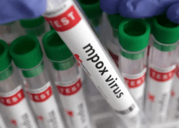 Reportan nuevos casos de Viruela del mono en CDMX y Edomex