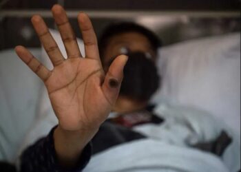 Suecia confirma su primer caso de viruela del mono