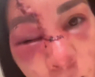 Irene Aldana reaparece tras corte en la cara en UFC