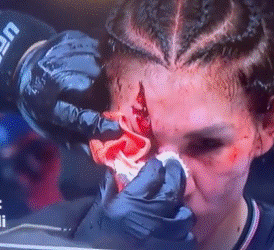 Irene Aldana sufre corte en la cara en UFC 3O6