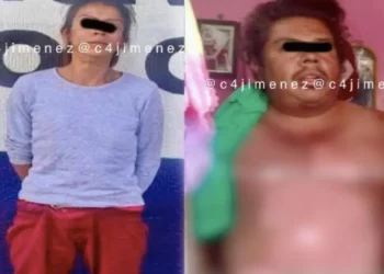 Mujer quema a su esposo por dinero