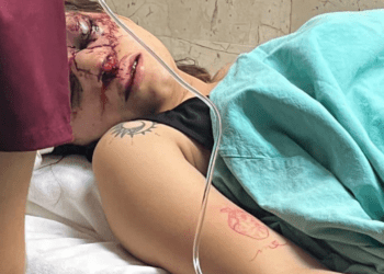 Joven de Tamaulipas es golpeada brutalmente por su novio