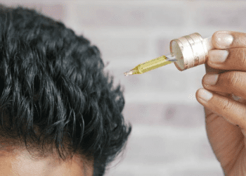 Medicamento contra la calvicie podría causar “síndrome del hombre lobo” en bebés