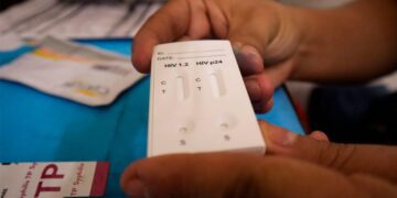 En el marco del Día Mundial del SIDA, IMSS refuerza medidas de prevención